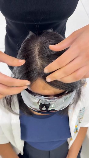 Frontal and crown hair thinning covered using a light weight topper, customised with curtain bangs 🤍 Topper used: 3x5” Silk Topper - Light Density in 12” NBB | 1 Hair Stop India