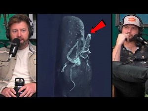 Forrest Galante Reacts to First Footage of Sperm Whale Eating a Giant Squid