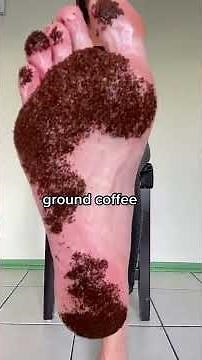 The daily struggle of having sweaty feet - Dermadry for hyperhidrosis 💙💧