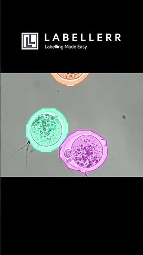 AI That Detects and Tracks Egg Cells Under a Microscope in Real Time