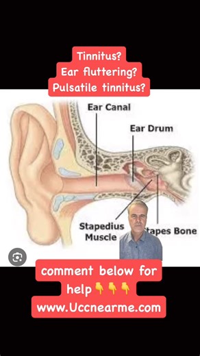 19K views · 156 reactions | #tinnitus and its variations can be caused by neck misalignment. Tinnitus is an inherently stubborn difficult condition to overcome. We find about 1/3 of tinnitus cases recover with #uppercervicalchiropractic ! Listen in! #uccnearme #earsringing #fyp #fluttering #pulsatiletinnitus | Upper Cervical Chiropractor Near Me | Facebook
