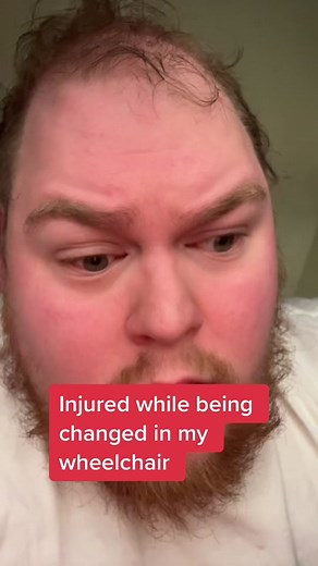 Injured While Being Changed in My Wheelchair: A Personal Story