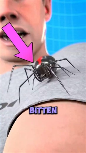 Spider Bite? Never Do This 😱