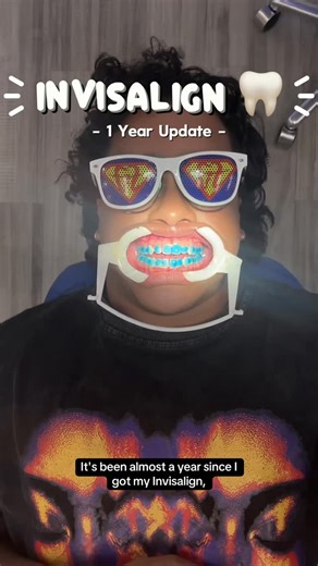 diego🌙 on Instagram: "1 year w/ Invisalign…who knows when the treatment’s over 😭 but honestly I’m loving my result, the focus rn is my crooked bite 😑 #invisalign #teeth #braces #smiletransformation #beforeandafter"