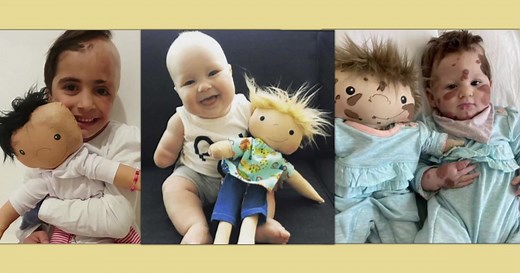 'A Doll Like Me': Helping children with disabilities feel seen through personalized dolls