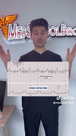 Memorize Fetal CTG’s in 60s!🤰🫀 Save this for your exams! #fyp #medstudent #medschool #medicalstudent #usmle #usmleprep #obstetrics #obgyn