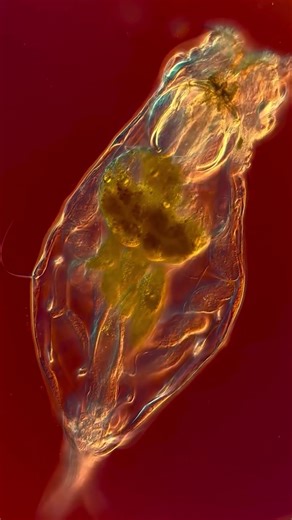 Vibrant Micro Worlds #microlife #microscope #flow