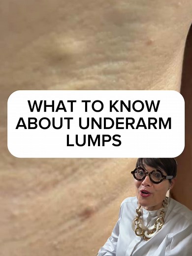 Understanding Armpit Lumps: Causes, Symptoms, & Treatment