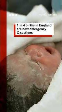 One in four births in England are now emergency caesareans, BBC analysis shows. #BBCNews