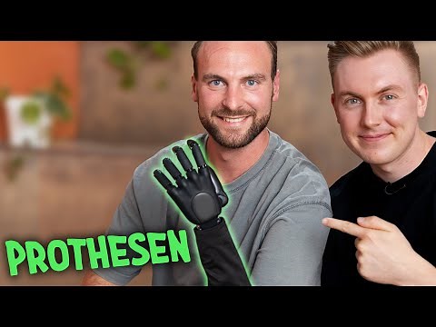 Wie lebt man ohne Arm?