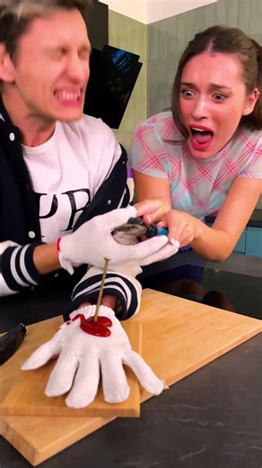 Nail-Biting Prank Gone Wrong! 😱 #shorts