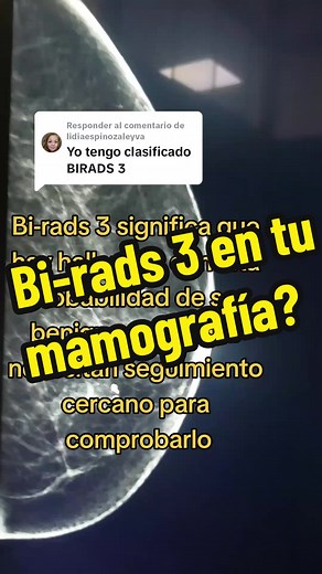 Guía sobre Bi-rads 3 en mamografía y su seguimiento