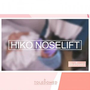 181 reactions · 26 shares | Be amazed at how painless and fast our Hiko Noselift procedure can be. Improve the shape of your nose without having to undergo invasive surgery. SPECIAL OFFER 20% OFF Upgrade you regular HIKO PDO to ULTRA V HIKO PCL the most trusted brand for V-LIFT and Nose Lift Threading with extended duration upto 2years compared to regular HIKO 12months only. #RedefiningBeauty #UltraV #HikoNoselift #Vlift | Toledo Medical Companies Inc. | Facebook