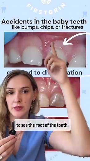 Dental trauma is really common among kids! #dentist #momtips #teeth #momlife #trauma | Pediatric Dentist Mom