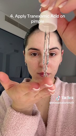 Safe Pimple Popping: Expert Tips for Clear Skin