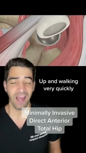 Minimally invasive hip replacement