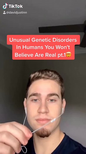 All of these shocked me omg... which one of these surprised you the most?? 😱😲 #unusual #disorder #prettycool