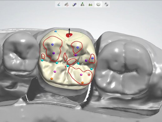 3shape设计46牙冠（简单，带讲解流程步骤）