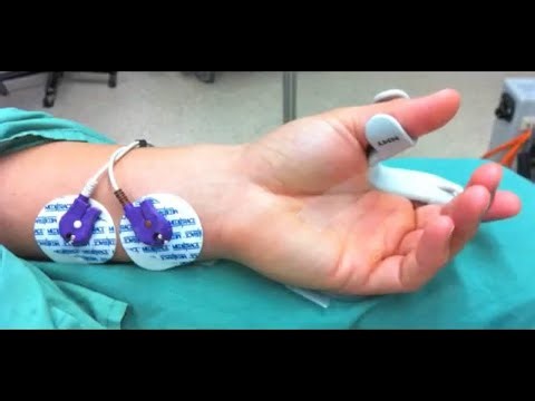 Monitoring neuromuscular function