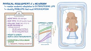 Video: Physical assessment - Neonate: Nursing - Video Explanation! | Osmosis | Osmosis