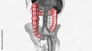 colon is also known as the large bowel or large intestine