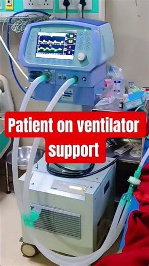 Patient on Ventilator Support | ICU Life Saving Machine Explained 🔥 #Shorts