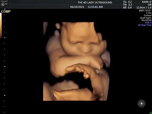 5.3K views · 154 reactions | 30 week snuggle bug getting sleepy and doing a little yawn | The 4D Ultrasound Lady | Facebook