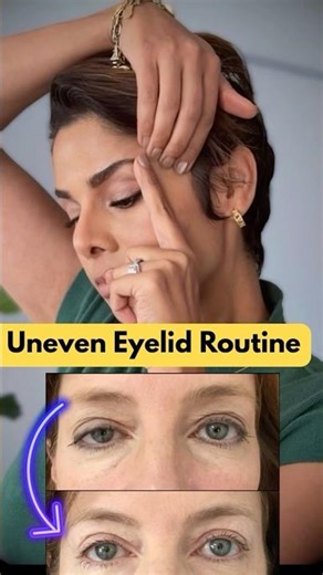 Face Yoga Routine for Uneven Eyelids — Before They Get Worse