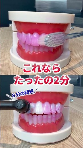 Transform Your Mouth in Just 2 Minutes! Revolutionize Your Daily Brushing with the Braun Electric...