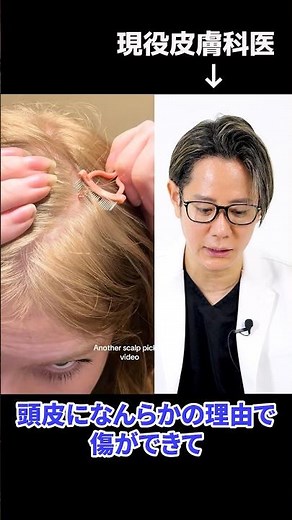 Is that scalp scab a sign of disease? A dermatologist explains #shorts
