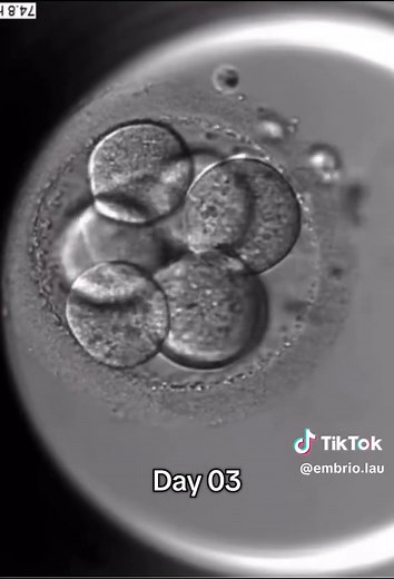 IVF Timelapse: Early Days of Embryo Development