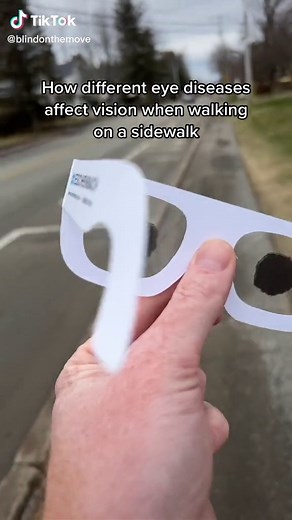 Eye Diseases & walking on sidewalks #instructorfortheblind #vision #eyediseases #simulation #visuallyimpaired