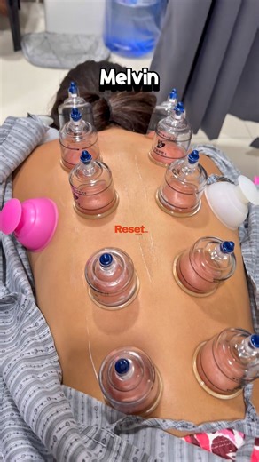 13K views · 98 reactions | With parent consent 14 yrs old swimmer athlete sports massage | Reset & Release PH | Facebook