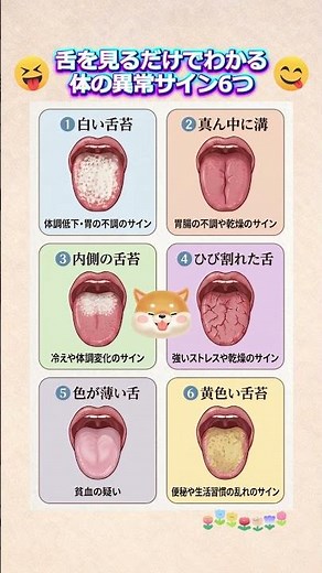 舌を見るだけでわかる体の異常サイン6つ #舌チェック #健康サイン #体の異常サイン #体調管理 #不調サイン