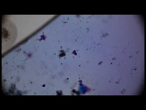 Xanthan hydration in a formulation with sorbitol