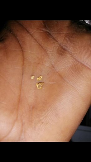 Exploring Gold Objects in an Outdoor Setting