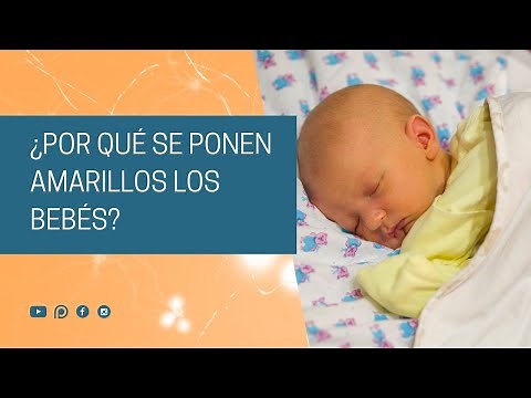 Why do babies turn yellow?
