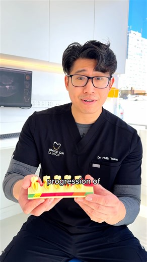 How do you know if you have gum disease? Gum disease is one of the most common oral health conditions and often develops gradually. It can occur when plaque and bacteria build up around the gums, causing inflammation and changes to the tissues that support the teeth. These are some of the early signs to look out for, why regular dental checks are important and how timely treatment can help manage the condition before it becomes more advanced. If you are experiencing bleeding gums, persistent bad