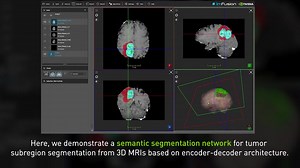 Research at NVIDIA: 3D MRI Brain Tumor Segmentation Using Autoencoder Regulari