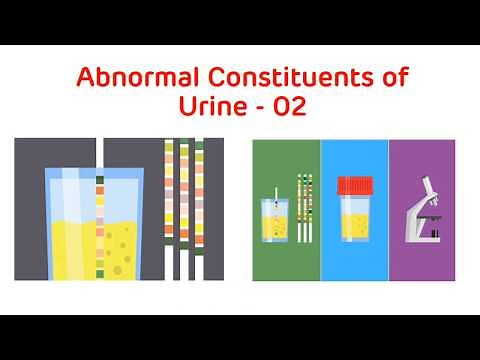 Analysis of Abnormal Urine || Abnormal Constituents of Urine Part 2 || Biochemistry Practical