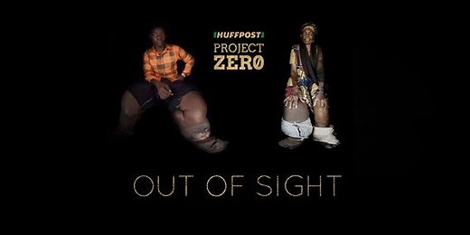 602K views · 1.7K reactions | Elephantiasis is a disease that's...