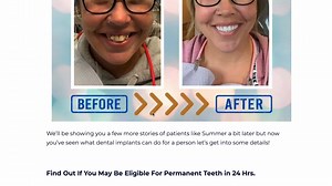 255 reactions · 18 shares | Patients often ask us: “How much do dental implants cost?” "What do the payment plans look like?" “How is Nuvia able to provide their permanent teeth in only 24 hours?” “What material are the teeth made of?” Click the button below to see our free guide where we answer all of these questions (and many more!) | Nuvia Dental Implant Center | Facebook