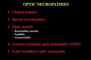 PPT - OPTIC NEUROPATHIES PowerPoint Presentation, free download - ID:6690296