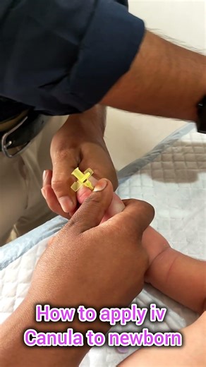 How to apply iv canula to newborn#viralvideo#hospital#newborn#ivcannulation#pediatrics#mbbs#ytshorts