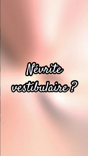 Névrite vestibulaire ? Cas typique 😷 #kine #sante