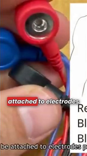 How to Make a DIY ECG Machine – Step-by-Step Guide