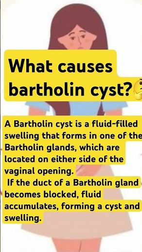 What causes bartholin cyst?