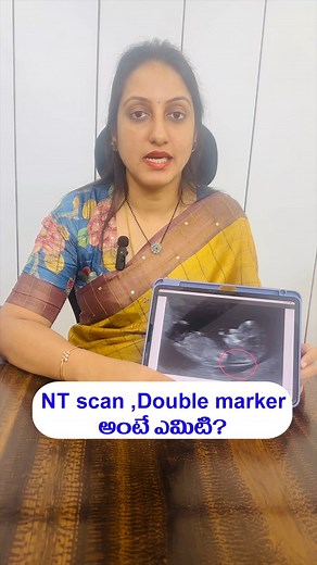NT scan,Double marker అంటే ఎమిటి? 👶 NT Scan (Nuchal Translucency Scan): • Done between 11–13 6 weeks • Measures the fluid behind the baby’s neck • Helps detect chromosomal abnormalities like Down’s syndrome and major structural issues 💉 Double Marker Test: • A blood test that measures β-hCG and PAPP-A • Combined with the NT scan, it gives a risk estimate for conditions like Down’s, Edward’s, and Patau syndromes 📊 Why it matters: • It’s non-invasive, safe, and gives early reassurance • If resu