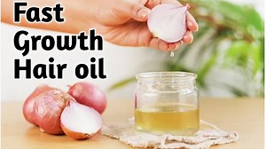 35K views · 1.4K reactions | Fast hair growth oil #hairgrowthoil #dandruffremoval #stophairfall #besthairoil | Simple Beauty Tips | Facebook
