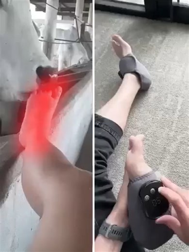 Neuropathie, engourdissement, fascite plantaire ? Ce dispositif soulage là où rien d’autre ne fonctionnait.